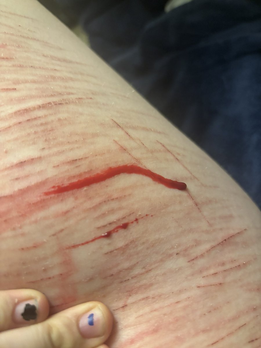 Giselle of shtwt tweet media