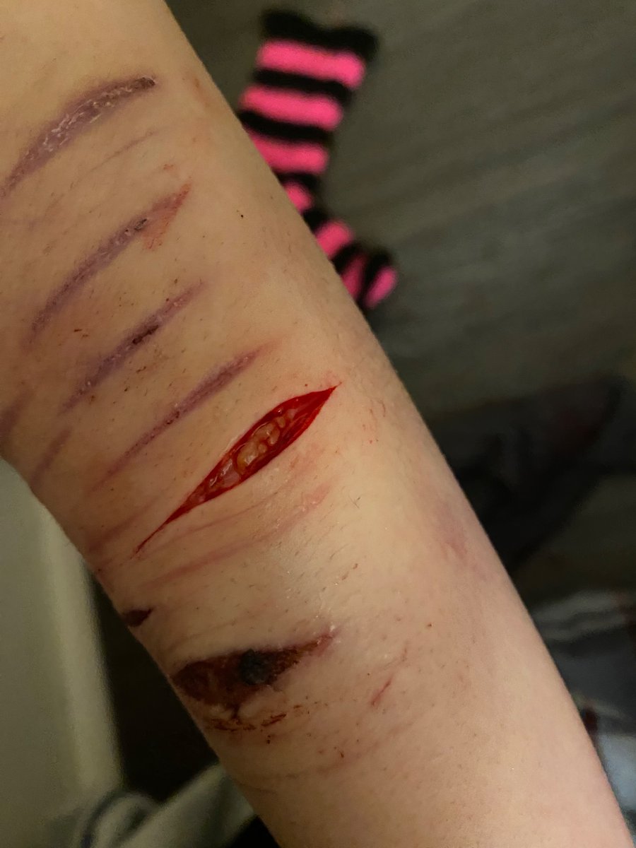 Rin🌼of shedtwt tweet media