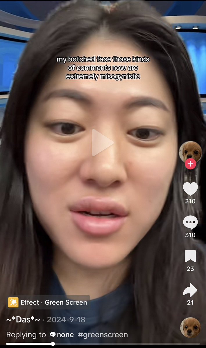 ᗩKᗩᖇI ❤︎ | ⊙⊝⊜ tweet media