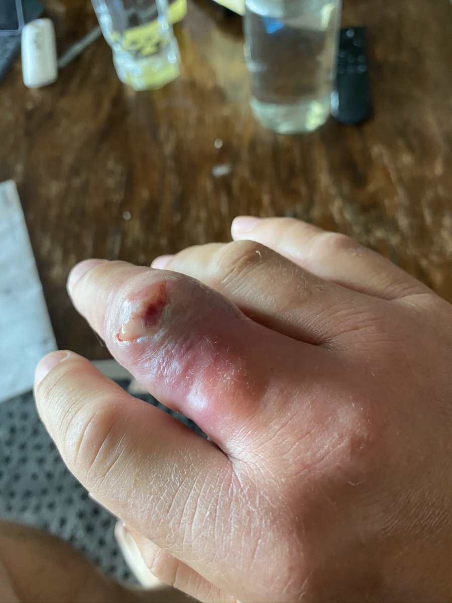 Peter Bonner tweet media