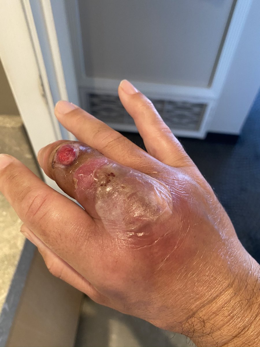 Peter Bonner tweet media