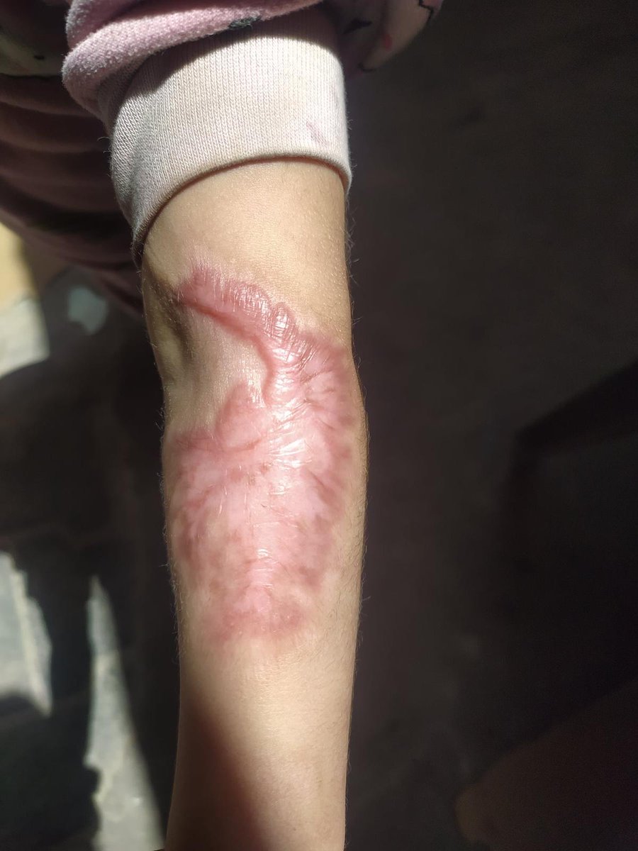 Lana & Hala Family's 🇵🇸🍉 tweet media