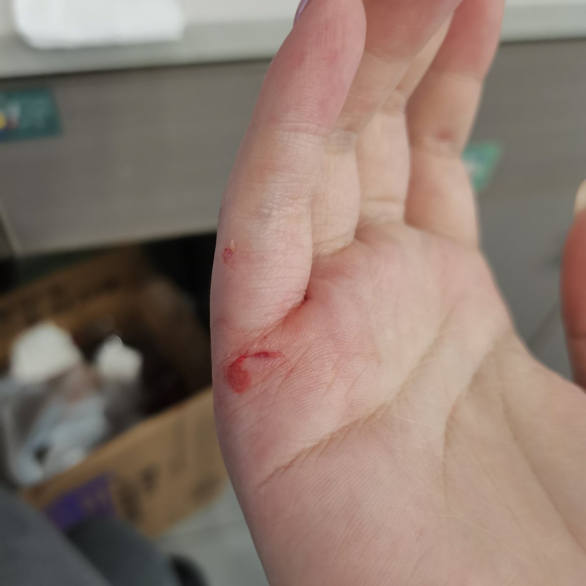 哎..