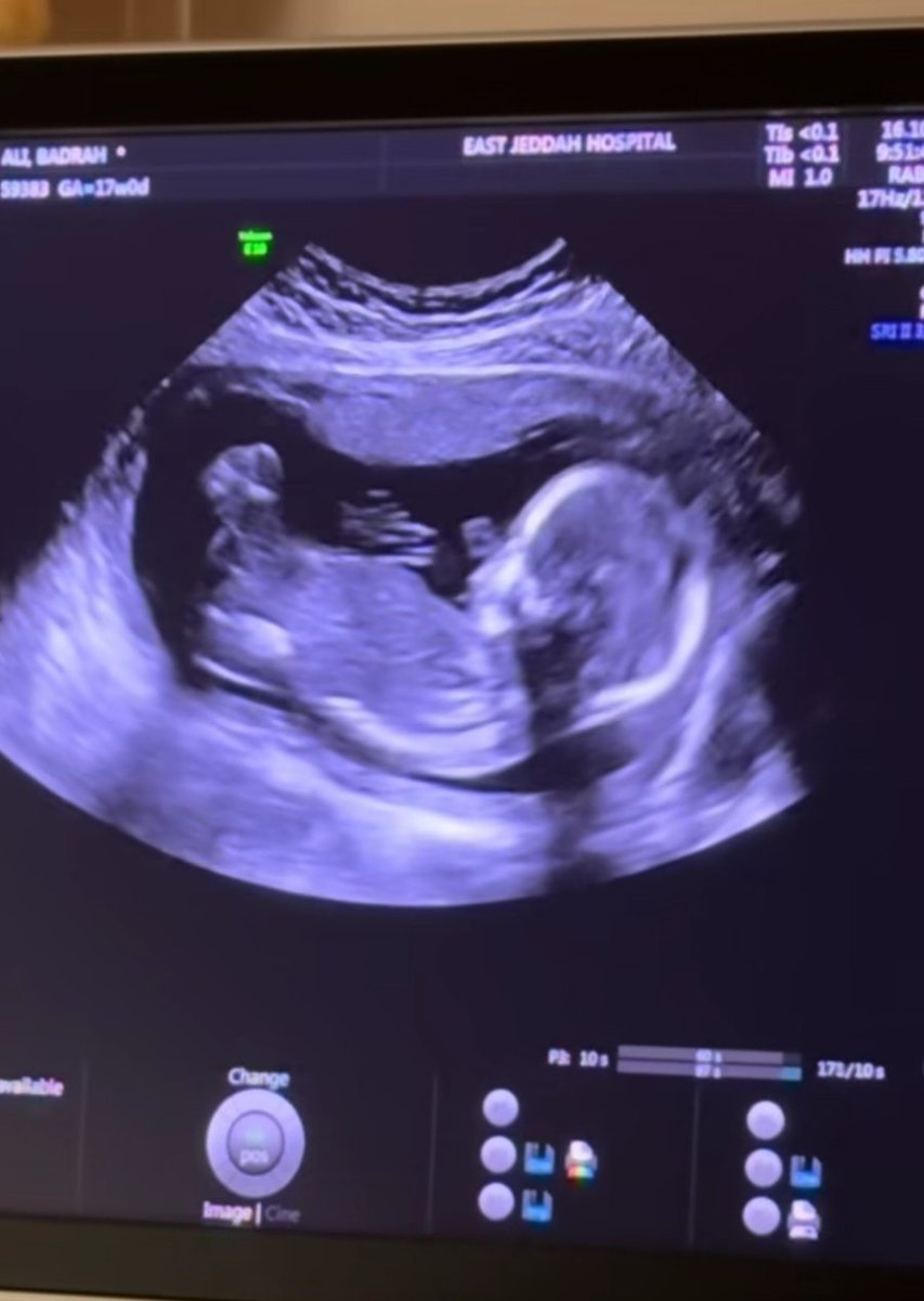 Wedad🇵🇸🍉 tweet media