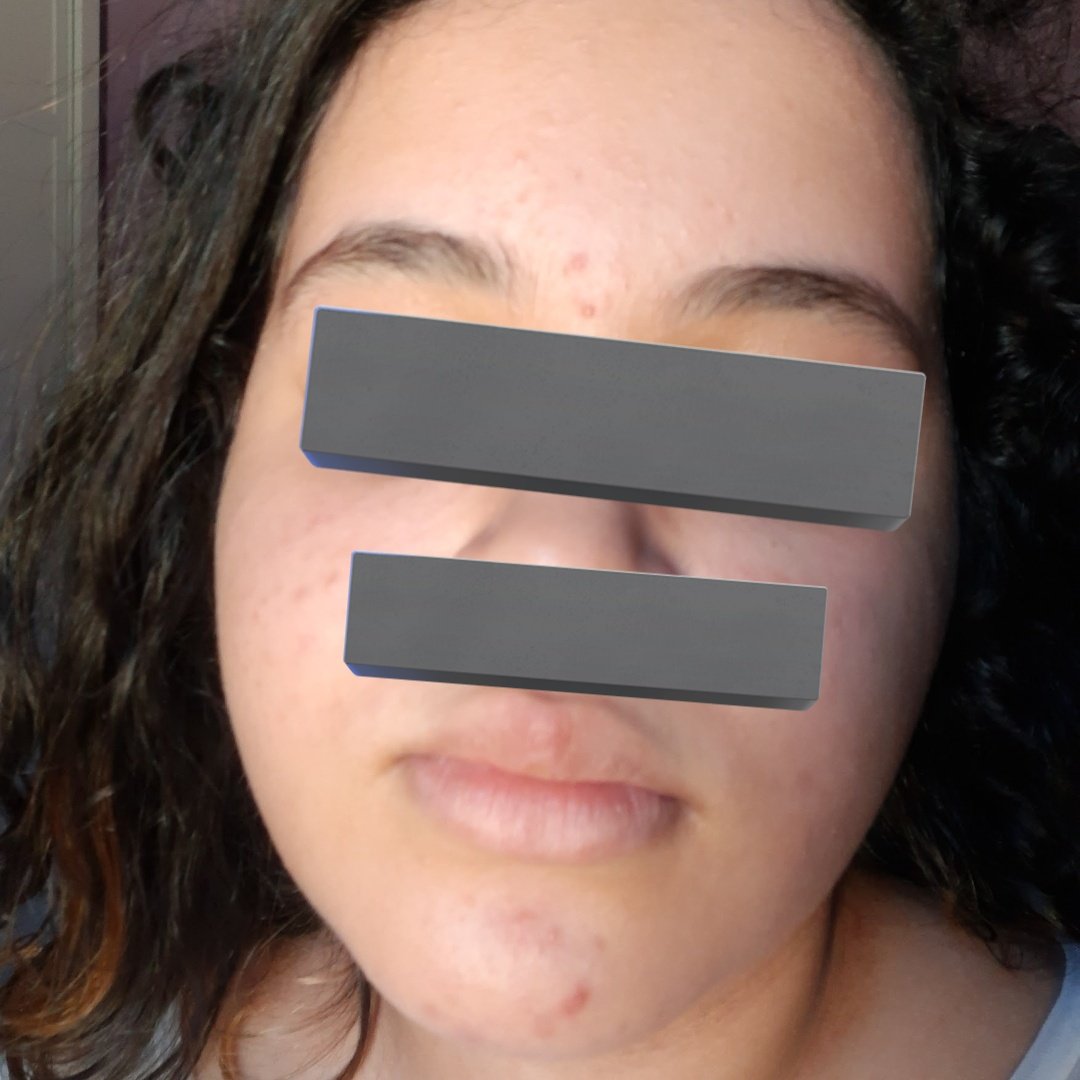 nami . 🍓 tweet media