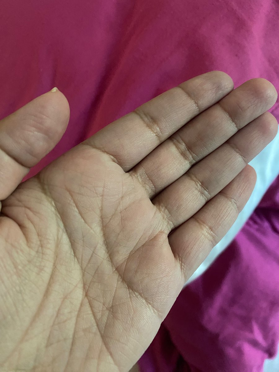 star pwME 😷 tweet media