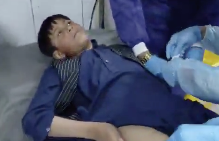 shafiburfat's tweet photo. These Afghan children are not terrorists; they are being killed and injured by the Pakistani army's bombings. Has the international community reflected on this brutality by Pakistan?
#World #Afghanistan #Iran #Sindhudesh #Jsmm @AfghanTimes7 @AfganPm @Mirwais1Afghan @syedjamal_agha @AfghanUrdu @afghan_1000 @UN @hrw @UNHumanRights