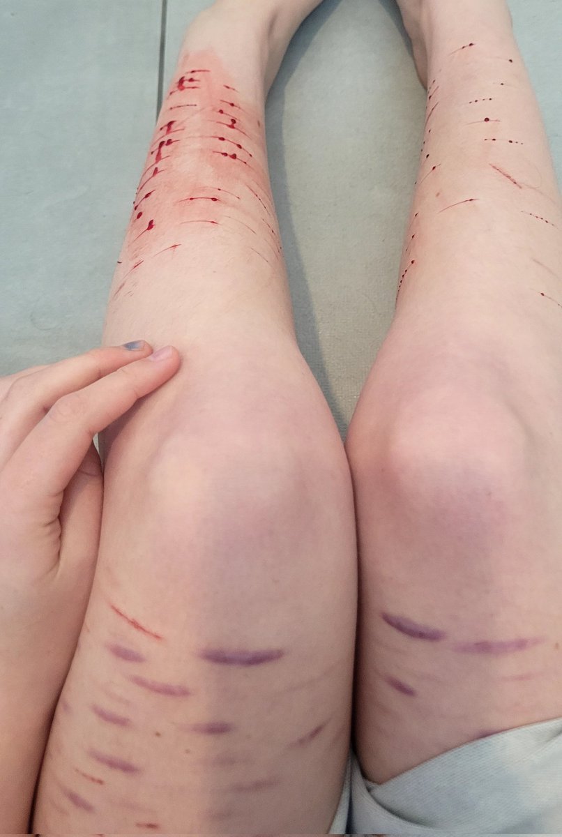 𝚛𝚎𝚗𝚖 tweet media