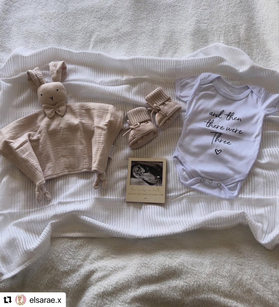 BBUKGossip's tweet image. Huge Congratulations to Big Brother 2025 Housemates, Elsa &amp;amp; Marcus who are expecting their first Baby together 

Due October 2026, So happy for you both 

📸 elsarae.x on Instagram 

#BBUK #BigBrotherUK