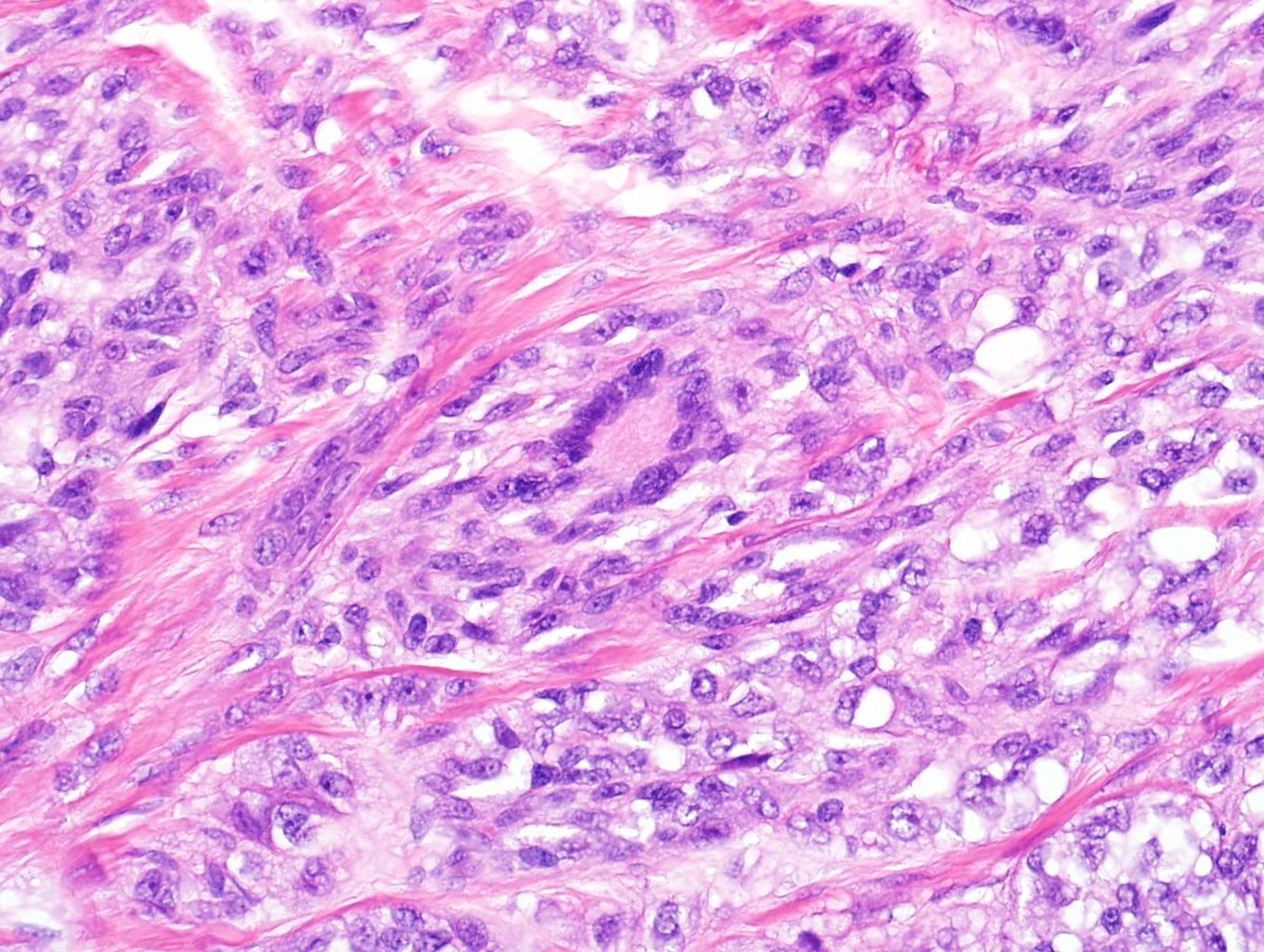 Charlie Herndon tweet media