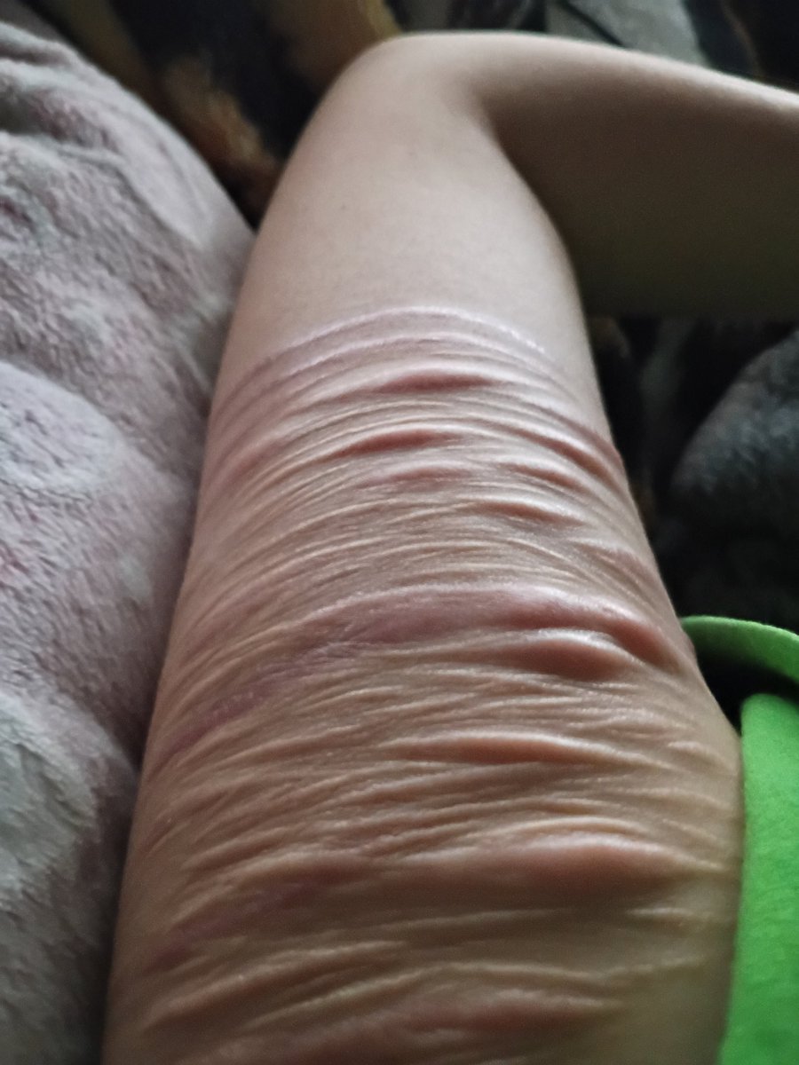 ☆Silas☆shedtwt!!!☆ tweet media