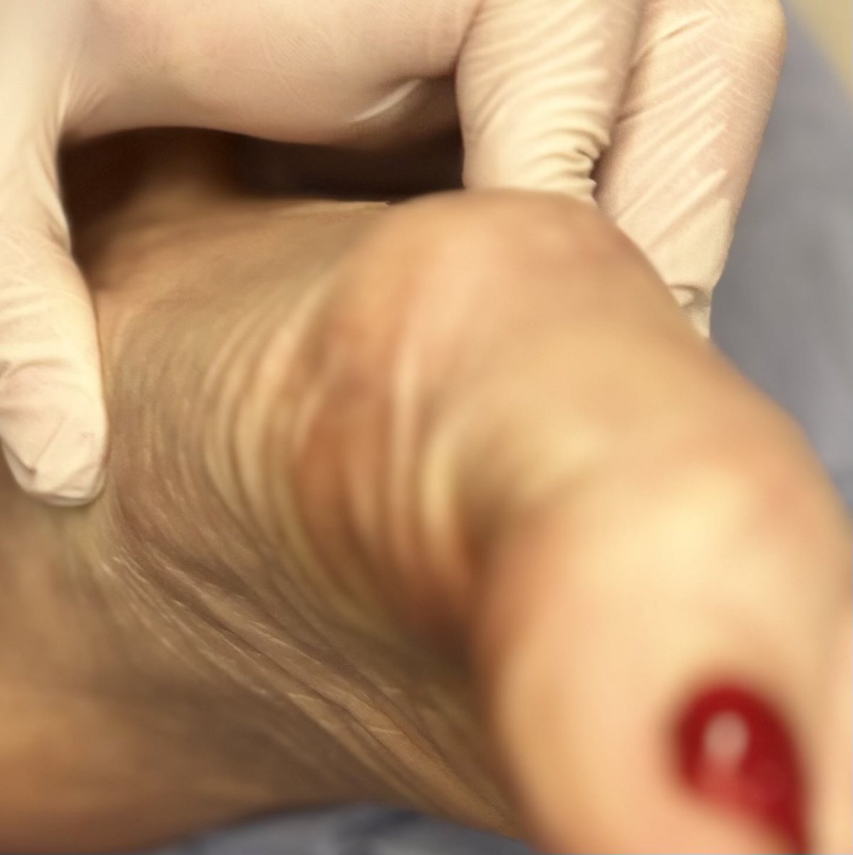 DrFootsyFox's tweet photo. New pedicure inspection just got a lot more intimate 👣
Gloved hands checking every wrinkle on these soft soles… who wants to be my next patient? 😈
Full uncensored medical foot worship session dropping on my OnlyFans — customs available too. Link in bio if you can handle the exam.

#FootFetish #MedicalFetish #Soles #FootWorship #FeetLovers #GlovedHands #FeetPics #FootPlay