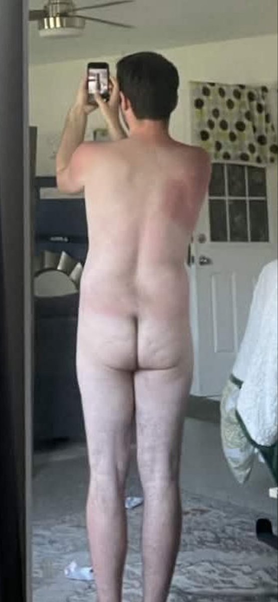 Numberone5412's tweet photo. In these photos, Jacob and Sierra are completely naked. The butts, the penis, the vagina, and her boobs are visible. 

#butt #booty #buttocks #bootybutt #bubblebutt #penis #balls #vagina #boobs #tinypenismatters #naked #nudity #sunburnwithabooty #tanlineswithabooty https://t.co/1XbwanfiWf