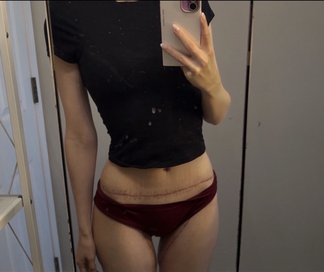 clover🪽💤 tweet media