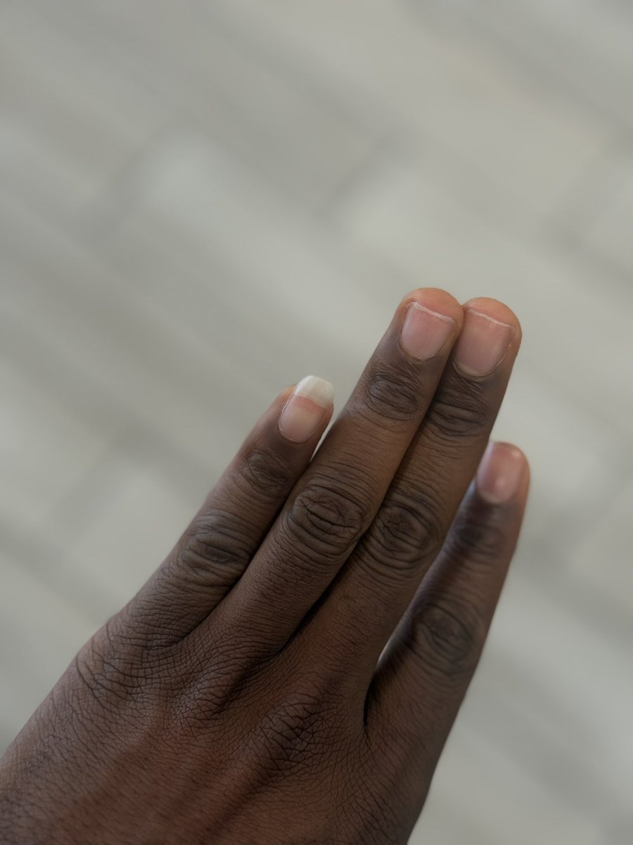 Lewis CJ tweet media