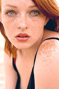 FreckledFace🧡 tweet media