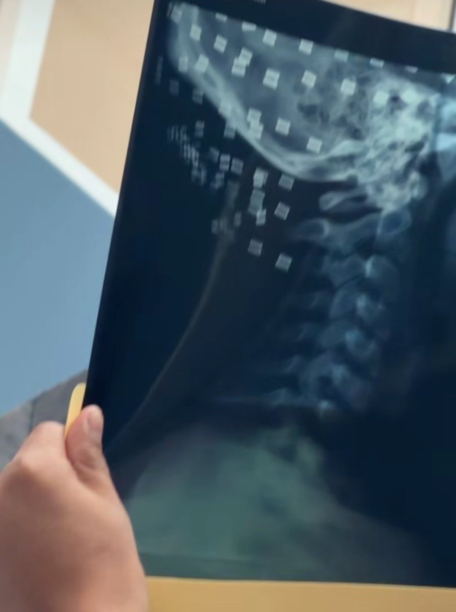 Fuku ✨🍒 tweet media