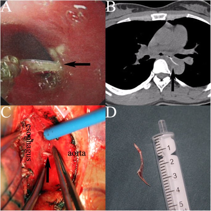 Keith Siau tweet media