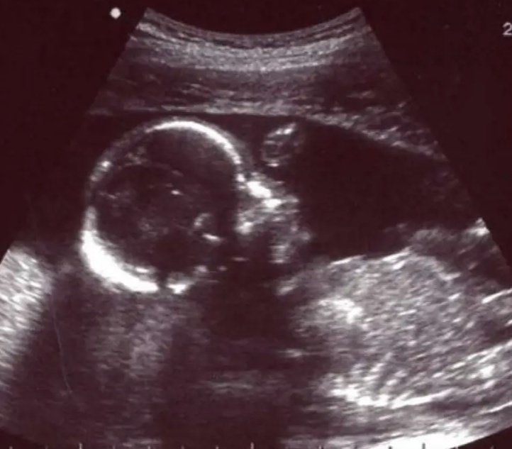 emma IS UNIQUE tweet media