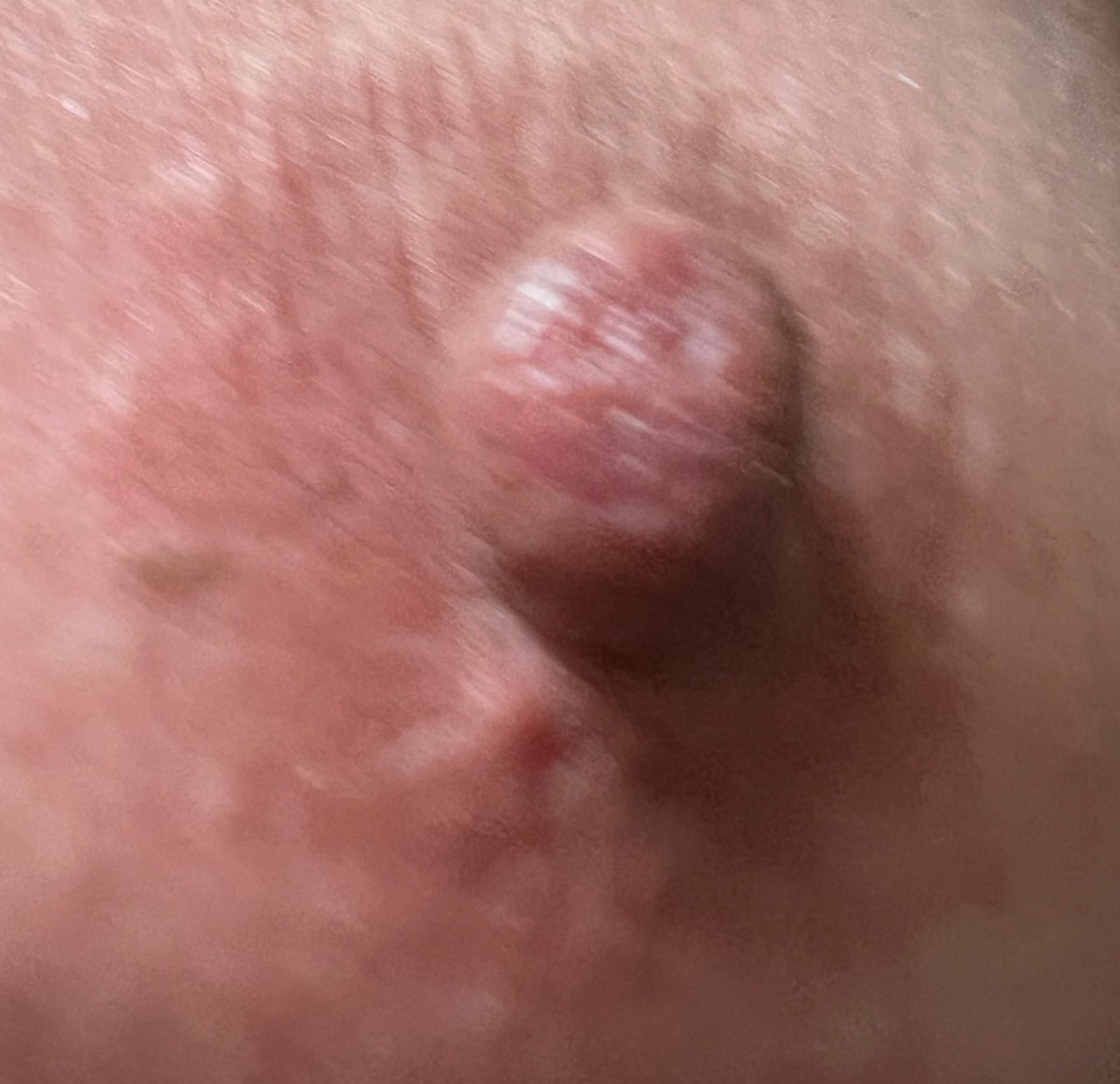 𝓟𝓸𝓸𝓱&𝓗𝓲𝓽𝓸𝓶𝓲🔞 tweet media