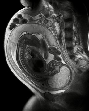 Julián Castellanos tweet media