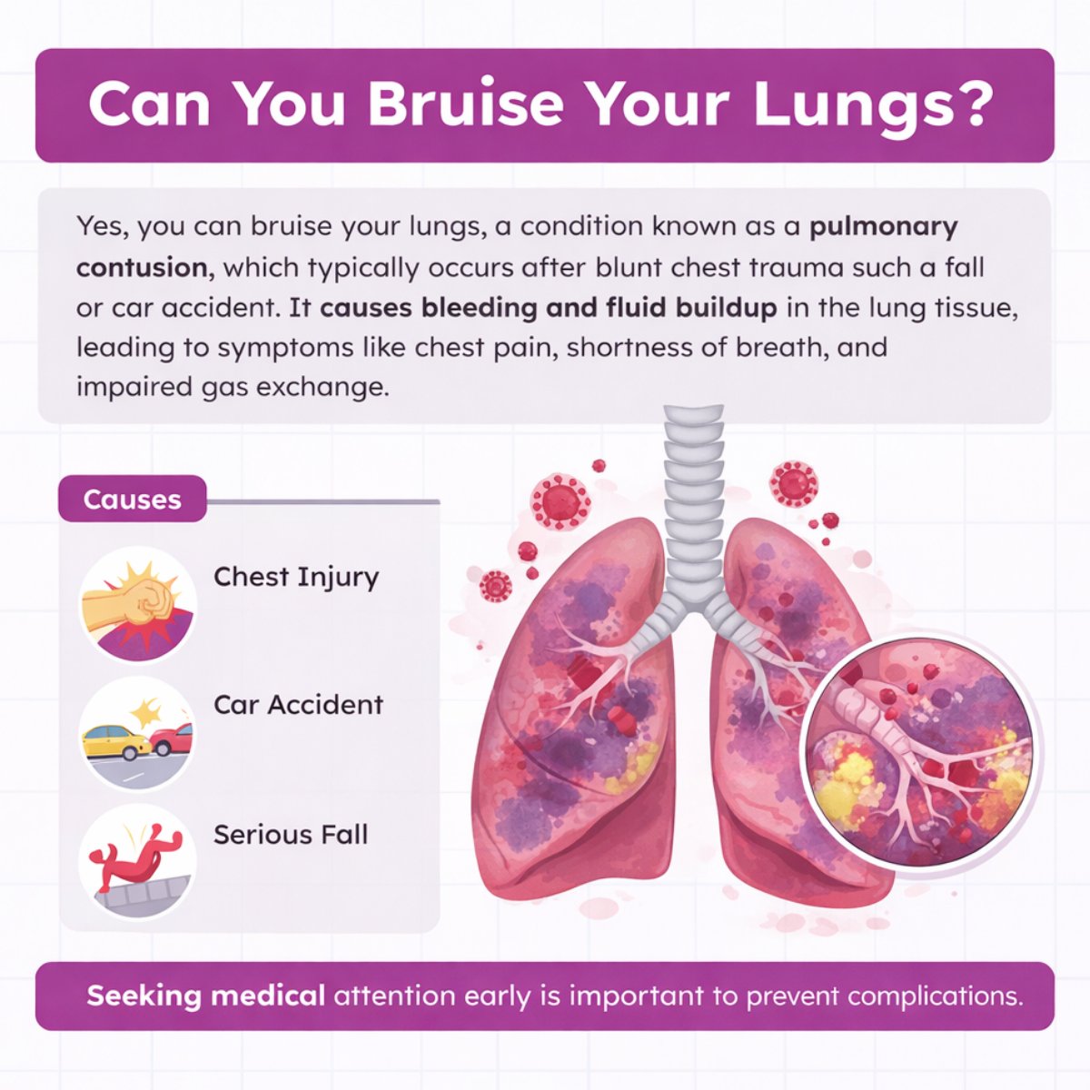 Respiratory Therapy Zone tweet media