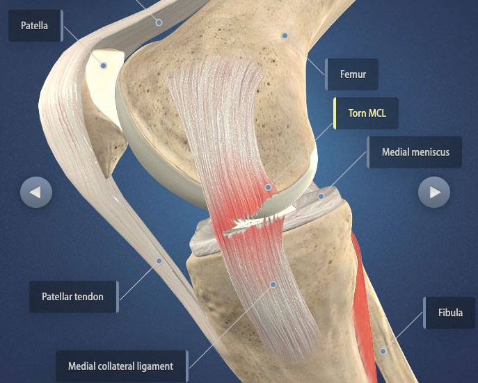 TwiloTwig's tweet photo. This seems to be getting likes from outside of caratland so let me provide context. 

In 2023 scoups tore his acl: a ligament responsible for stability in your knee. The injury has been known to be a career ender in many athletes. Recovery is long and hard. https://t.co/qjHOcEr2Mq