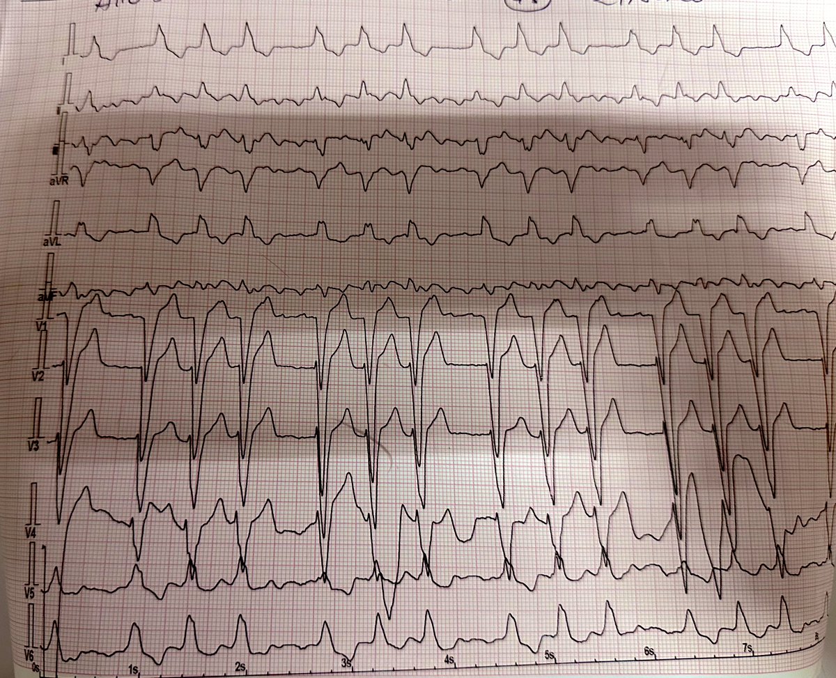 Homero Malandro tweet media