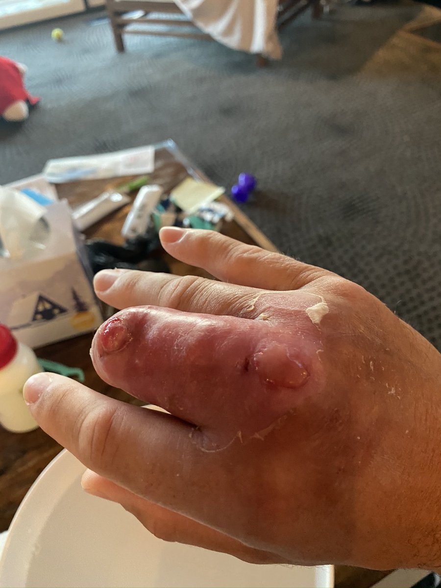 Peter Bonner tweet media