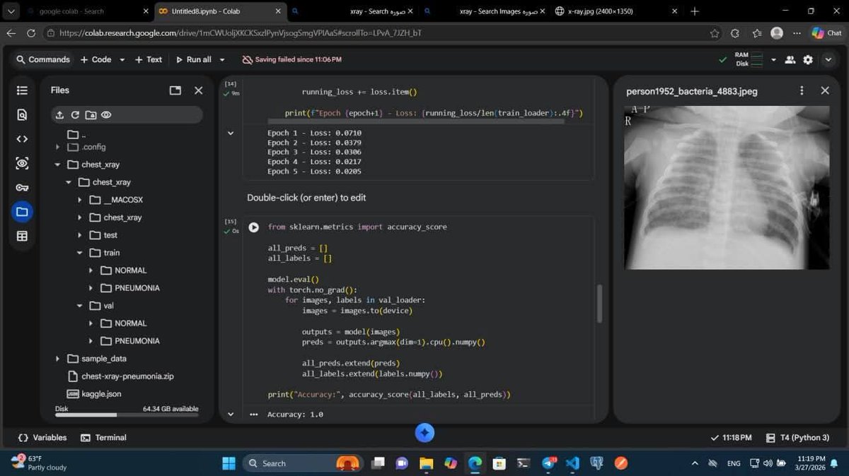 الحمدلله🤍

"مشروع Ai لتشخيص امراض الرئه من صور الاشعه" 

الحمدلله خلصت تدريب موديل كامل علي pytorch + Colab 
عملت fine tuning علي موديل EfficientNet علي dataset 
تحتوي علي train, test,val
عملت technical حمايه من ال overfitting سواء Data augmentation, Dropout, Earlystopping