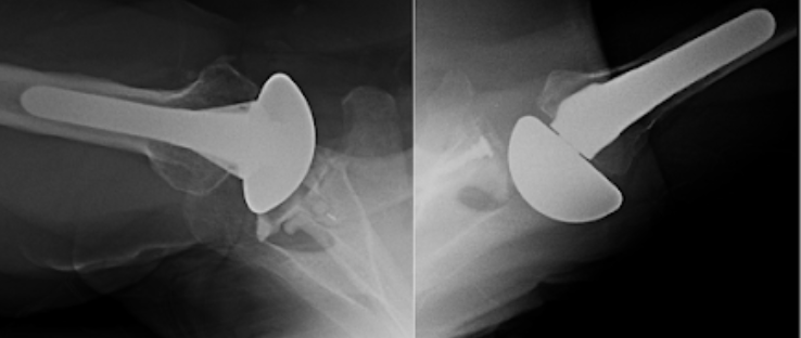 Rick Matsen tweet media