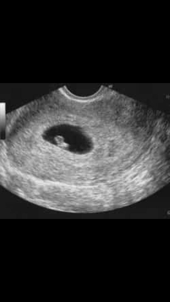 White Baby Factory tweet media