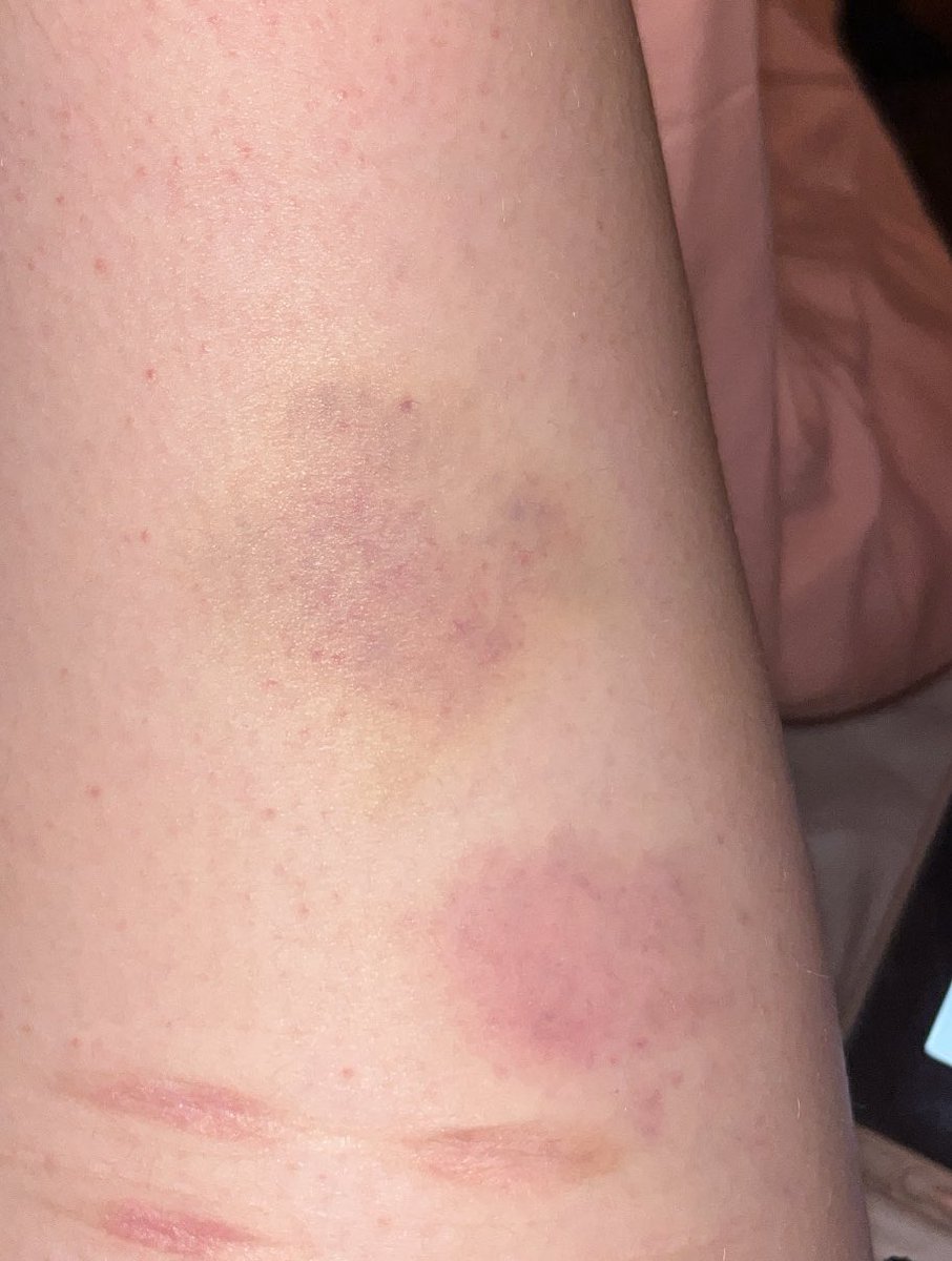 ʚbambi 🍓 edtwt tweet media