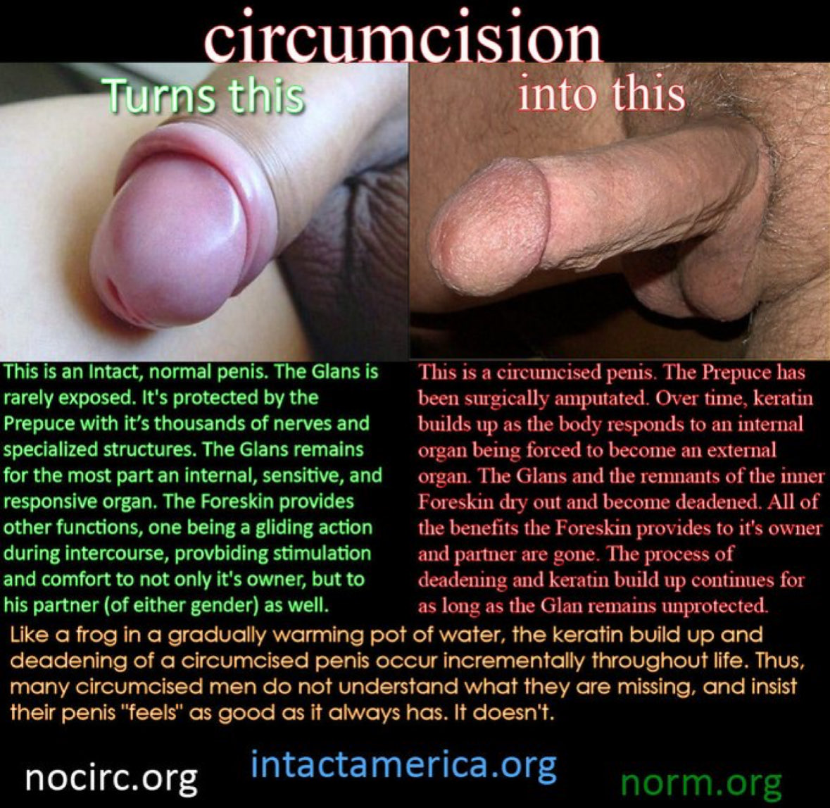 Ban the Snip tweet media