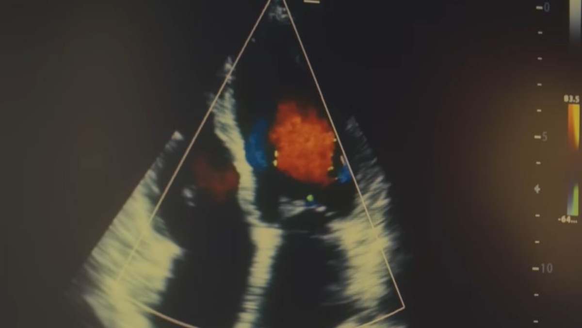 이슈피커 ISSUEPICKER tweet media