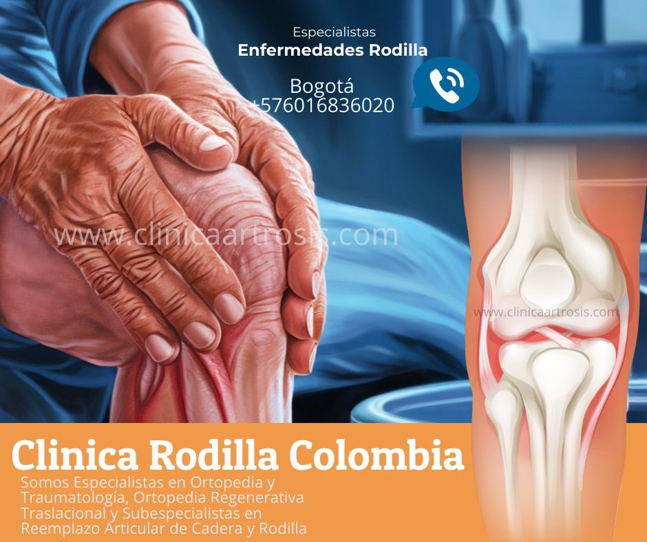 Dolor articular que limita tu vida? No es la edad… es la señal de actuar.

La artrosis u osteoartritis no solo desgasta el cartílago…
también afecta tu movilidad, tu independencia y tu calidad de vida.

Hoy, la medicina moderna ofrece soluciones más avanzadas