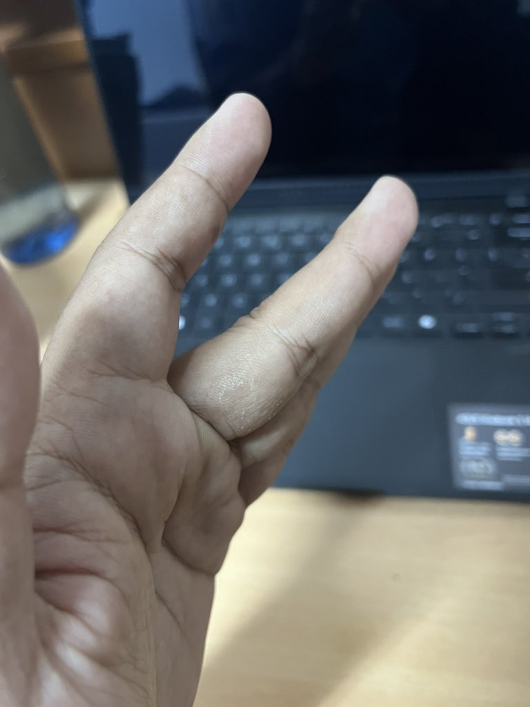 Eka Ramadhan Putra tweet media