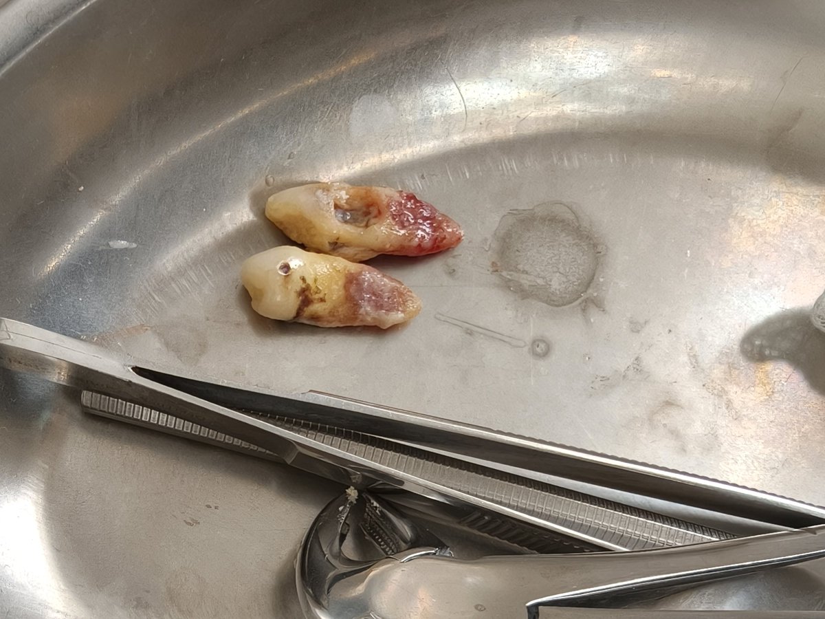 Iqbal Saputra tweet media