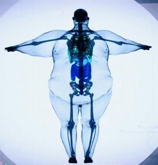 Lime - EDtwt tweet media