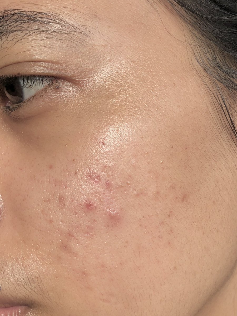 issa🦋🎀 tweet media