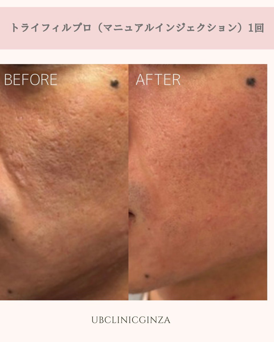 美容皮膚科 UBCLINIC銀座（UBクリニック銀座） tweet media