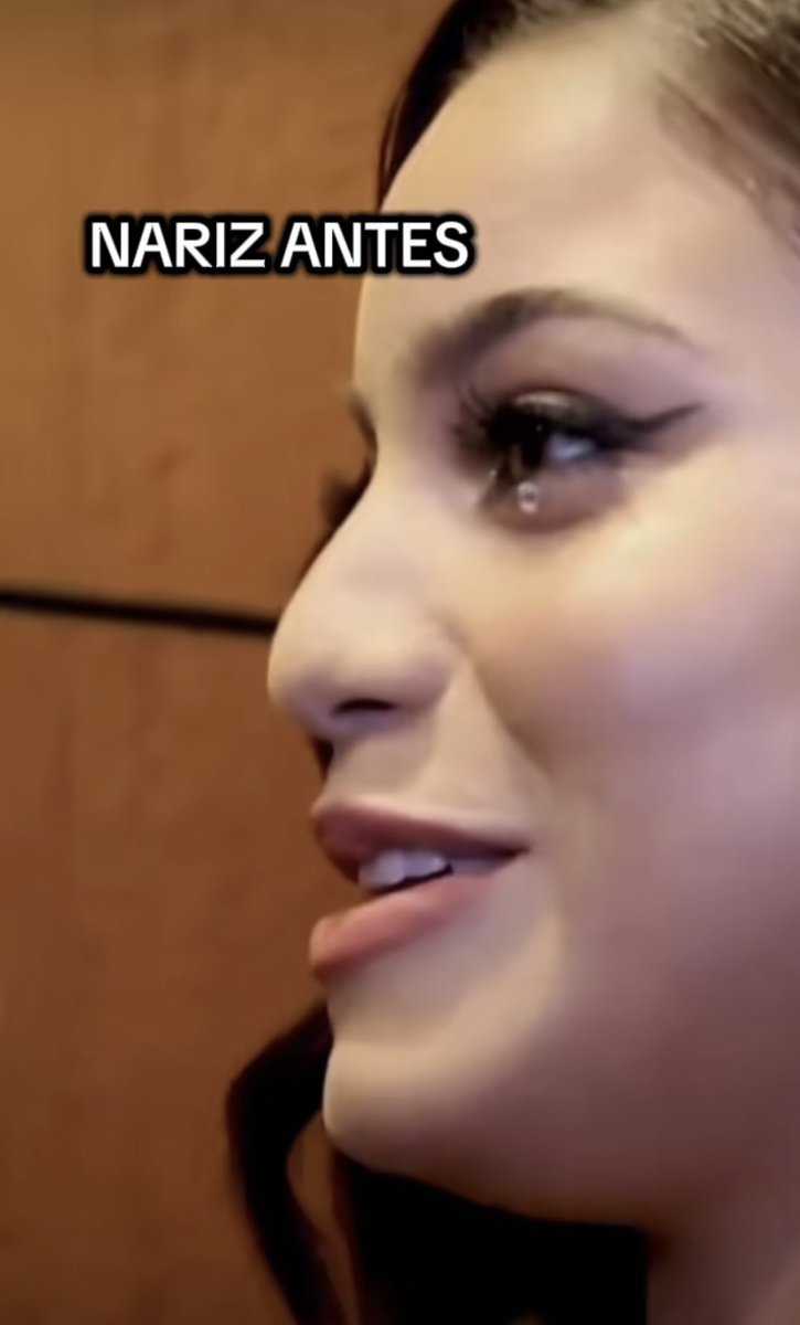 Fer 🐔91218 tweet media