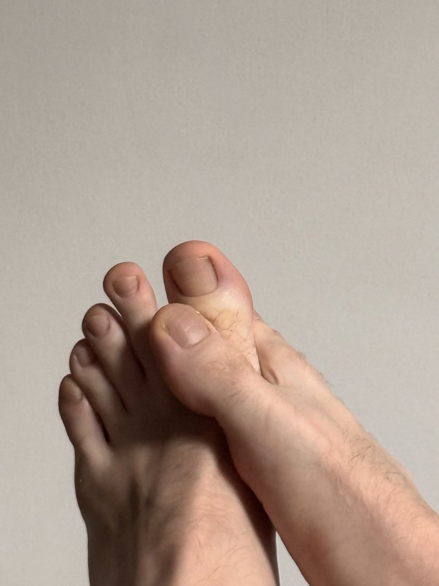 Daniel | the best toes 🐾 tweet media