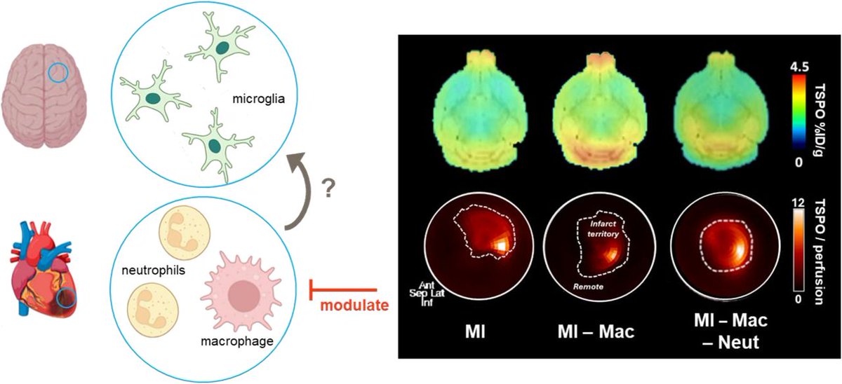 JournalofNucMed's tweet photo. After myocardial infarction, PET imaging can sensitively monitor response to immunomodulatory intervention and enable tracking of therapeutic efficacy at the site of injury and distant organ systems. https://t.co/gAGK3aLyNH

#NuclearMedicine #PETimaging https://t.co/4GrOFtiiyy