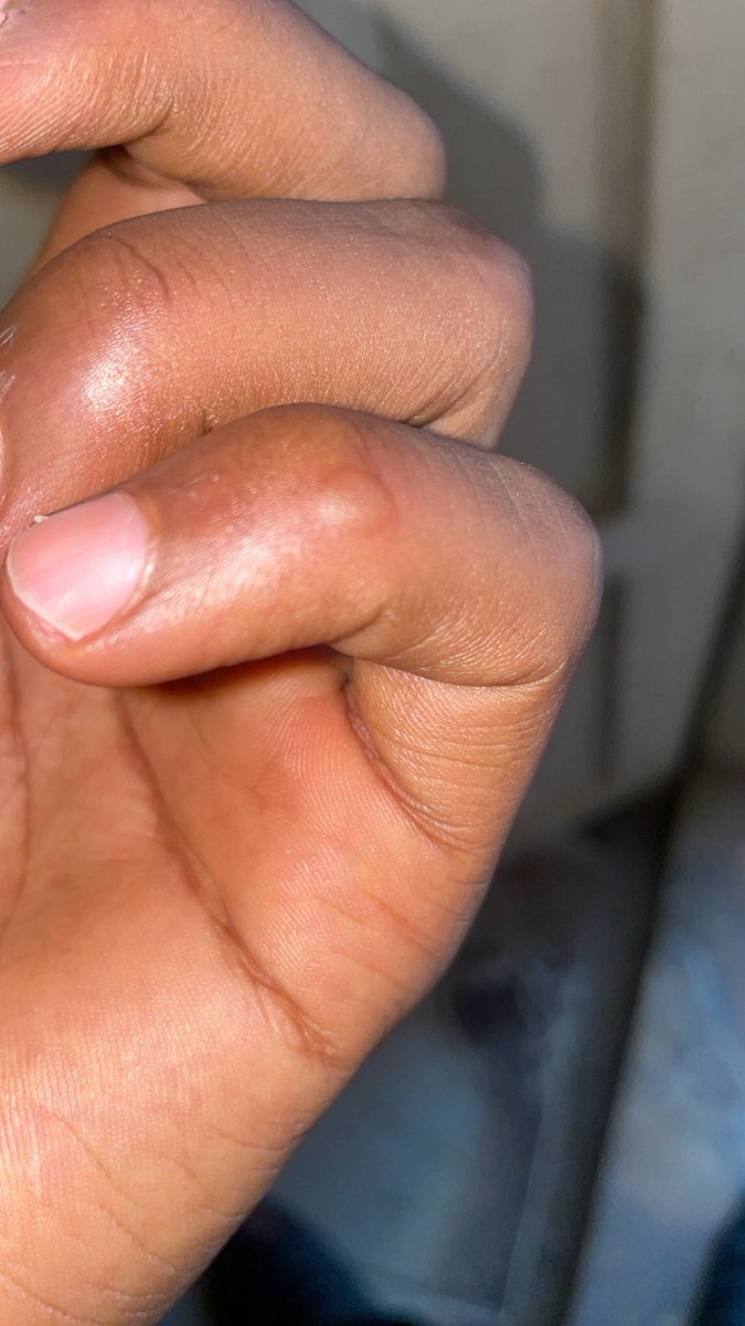 Ehis🦇🦇 tweet media