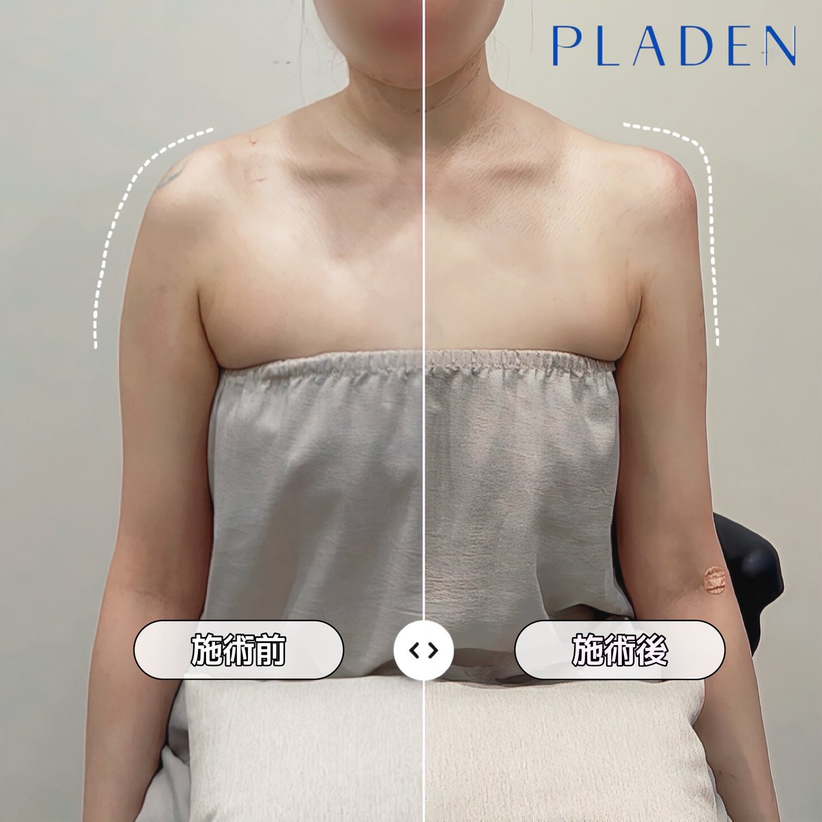 【公式】プラデン美容整形外科 tweet media