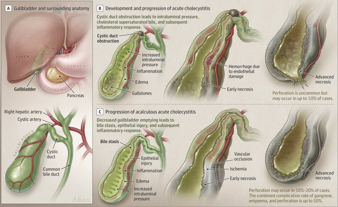 Sociedad Española de Patología Digestiva (SEPD) tweet media