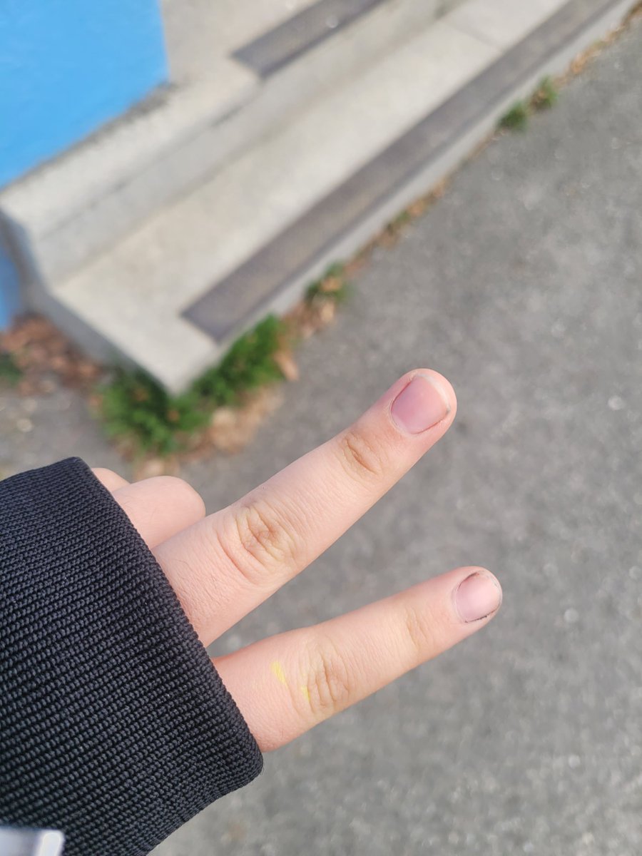 나는야 유리멘탈 tweet media