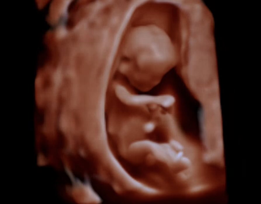 사타곰마💉 tweet media