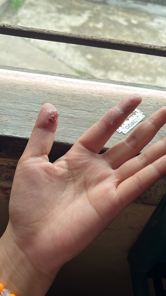 Matchaluv tweet media